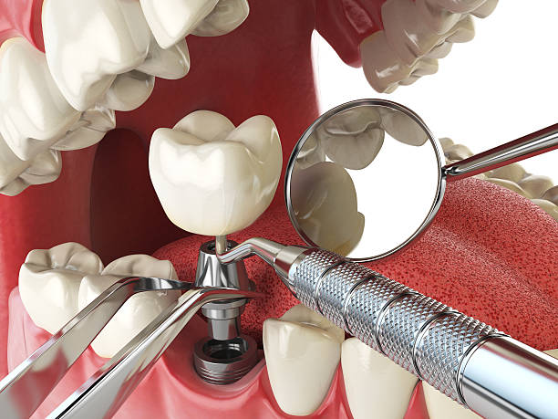 Best Walk-In Emergency Dentist in Walker, LA